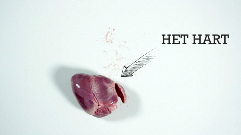 Dissectie van het Hart!