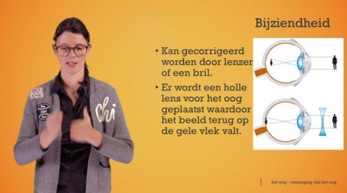 Video Het oog: bijziendheid -  2de graad