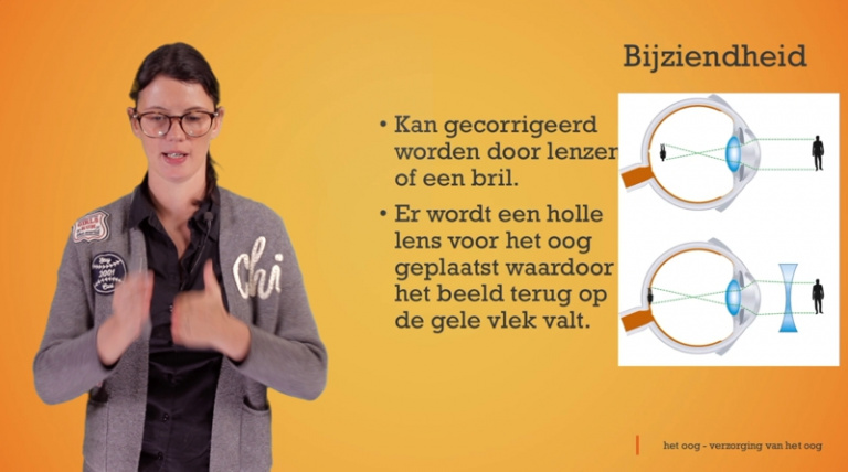 Het oog: bijziendheid