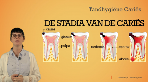 Video Tandhygiëne: cariës -  1ste graad A